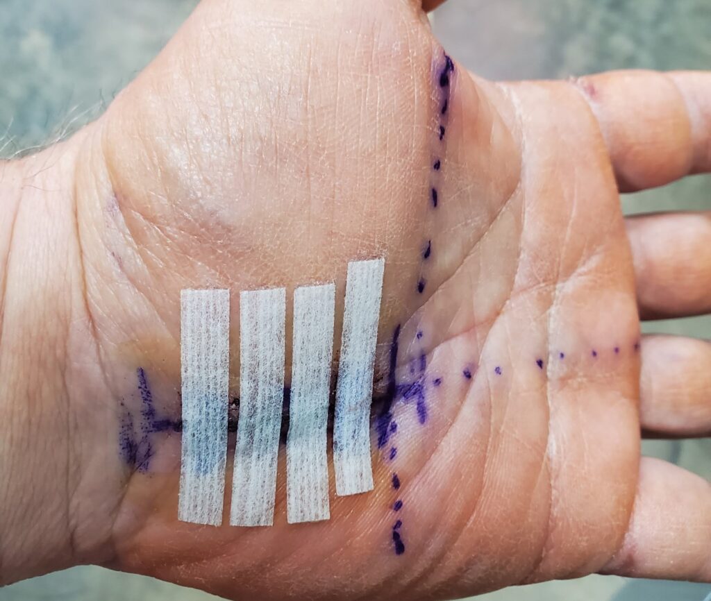 hand